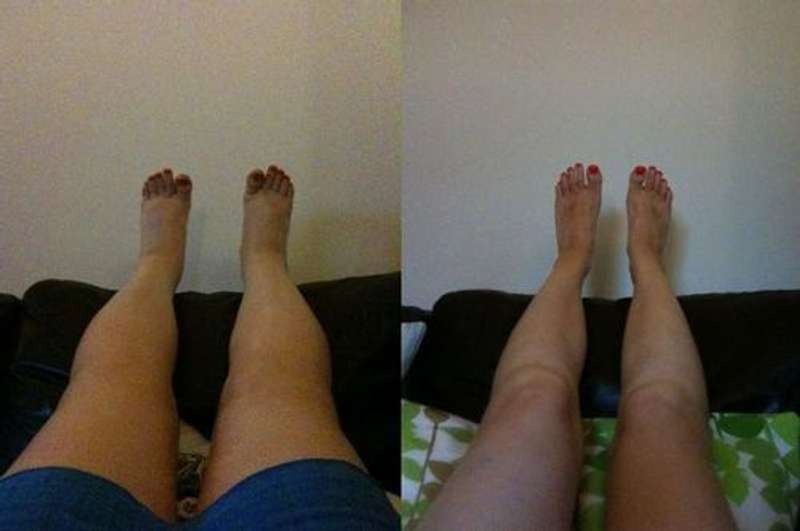 ChausseForm™ – Des jambes fines et une peau ferme en un seul geste !