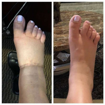 ChausseForm™ – Des jambes fines et une peau ferme en un seul geste !