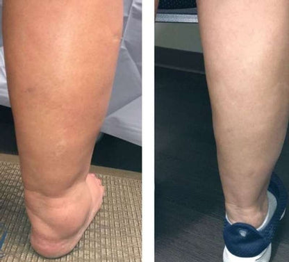 ChausseForm™ – Des jambes fines et une peau ferme en un seul geste !